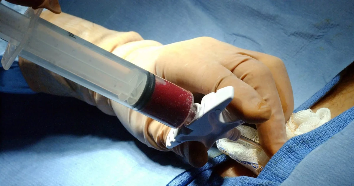 Thúc đẩy y học tái tạo nhưng không “thần thánh hóa” tế bào gốc
